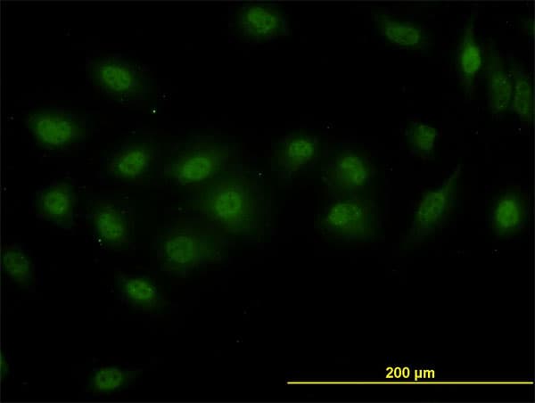 IHC-plus™ Requiem / DPF2 Antibody (clone 2F6)