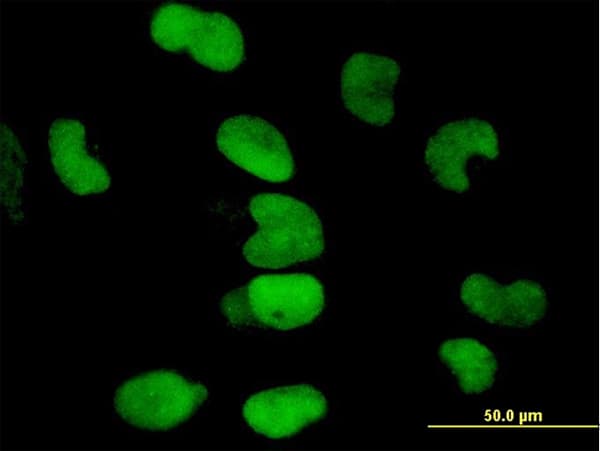 IHC-plus™ TRIM28 / KAP1 Antibody (clone 4E6)