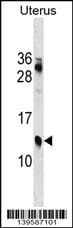 Polyclonal Rabbit anti-Human KLKP1 Antibody (aa 1-30, N-term, WB)