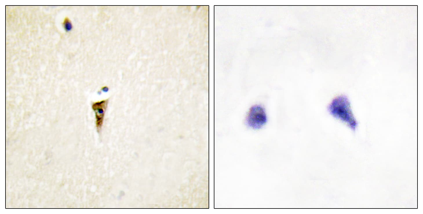 ICK Antibody (aa241-290)