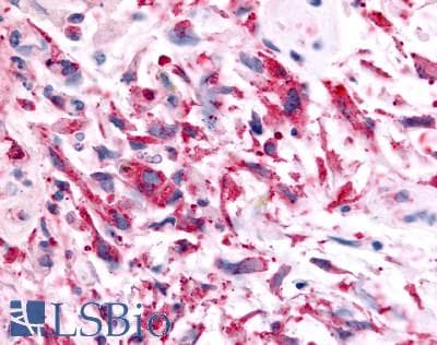 PathPlus™ GPR119 Antibody (Cytoplasmic Domain)