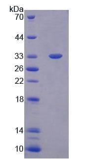 Rabbit IgG1 Protein (Recombinant His, N-terminus + Rabbit IgG Fc, C-terminus)