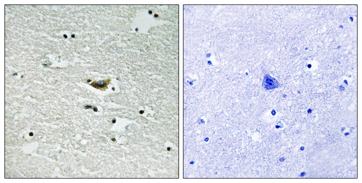 CSNK1A1 / CK1 Alpha Antibody (phospho-Tyr294)
