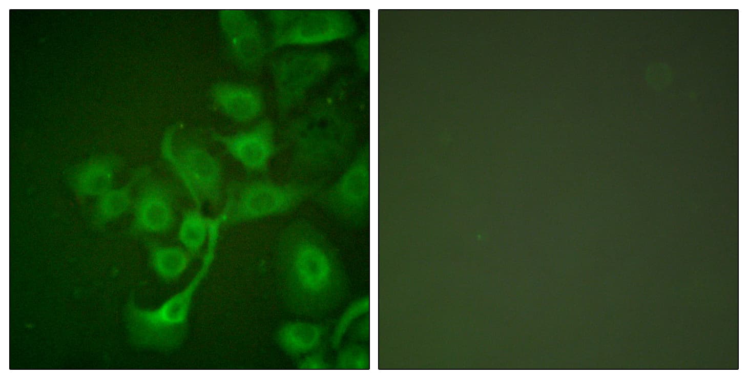 TIMP2 Antibody (aa21-70)