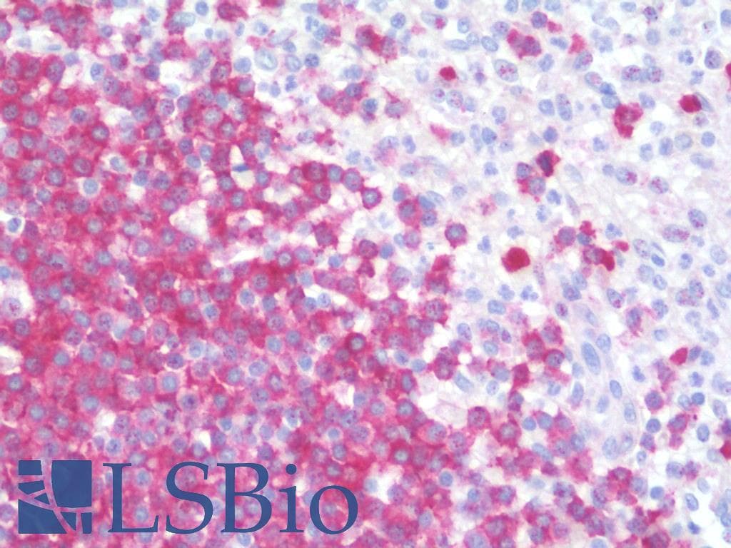 IHC-plus™ CD22 Antibody (clone 1B1)