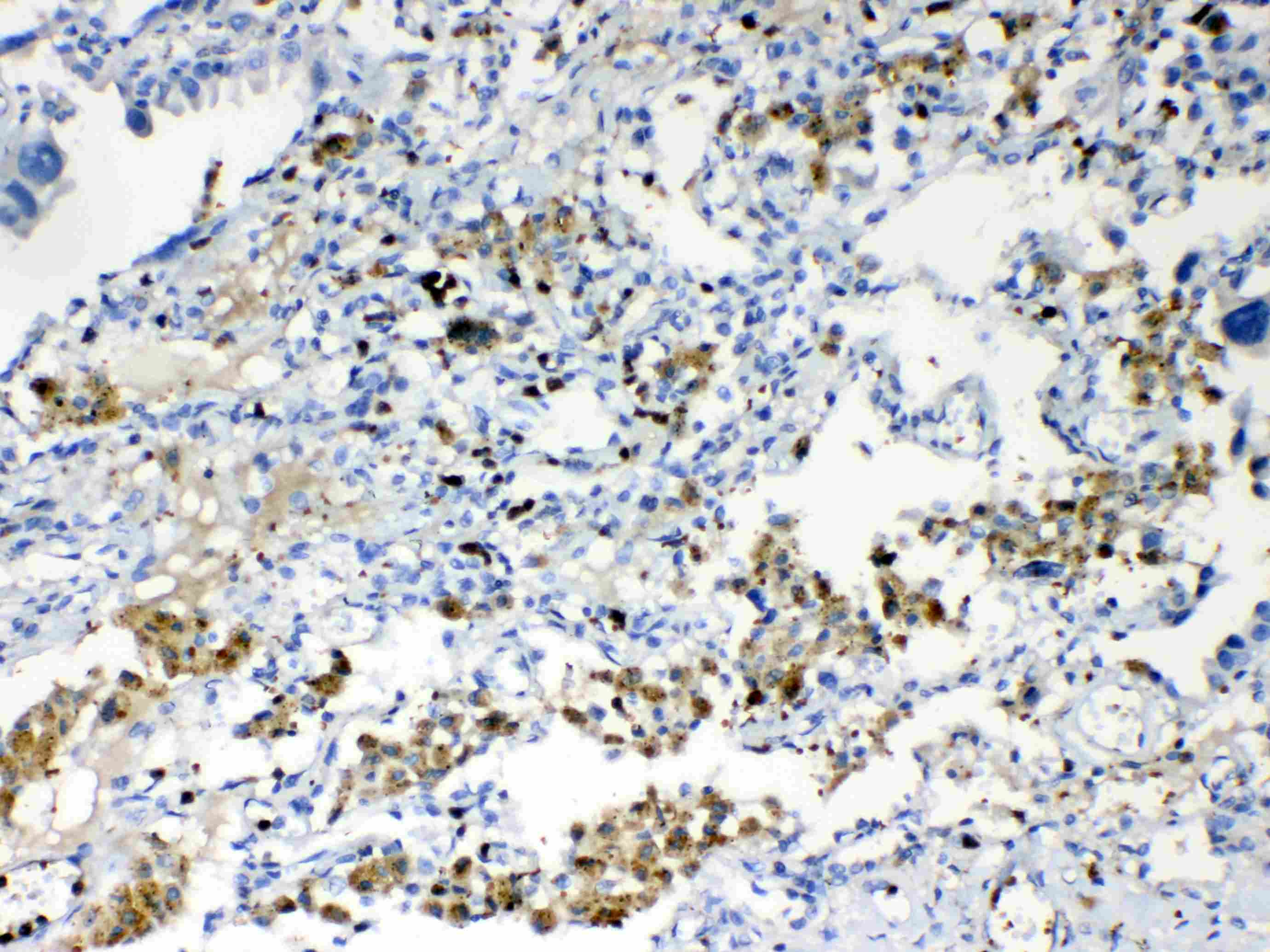 Polyclonal Rabbit anti-Human TMEM107 Antibody (IHC, WB)
