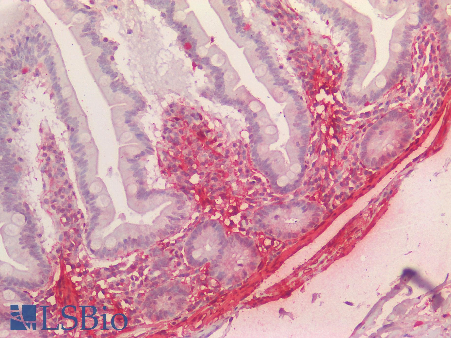 IHC-plus™ TAGLN / Transgelin / SM22 Antibody (C-Terminus)
