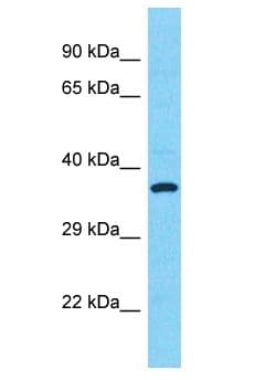 Polyclonal Rabbit anti-Human SULT1C2 / Sulfotransferase 1C2 Antibody (aa6-55, WB)