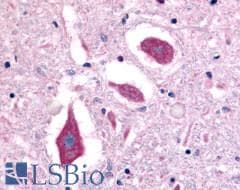 PathPlus™ NTSR2 / NTR2 Antibody (Extracellular Domain)