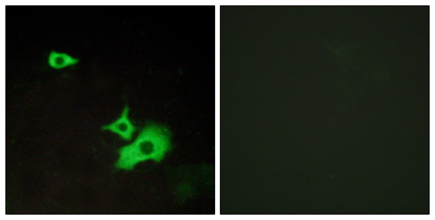 GPR37L1 Antibody (aa1-50)