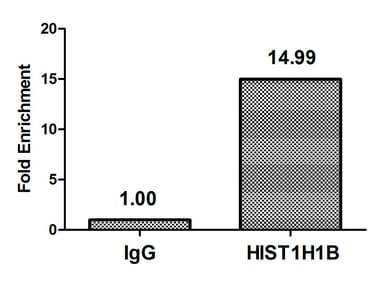Polyclonal Rabbit anti-Human HIST1H1B Antibody (phospho-Thr154, WB)