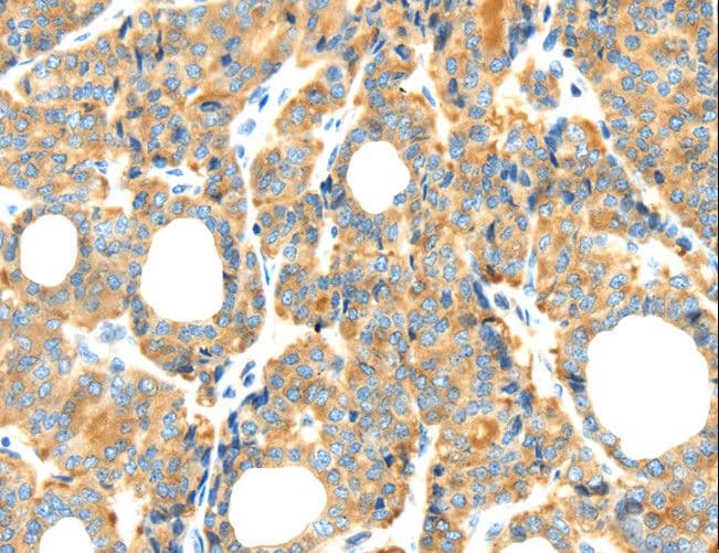 RIP4 / ANKRD3 Antibody