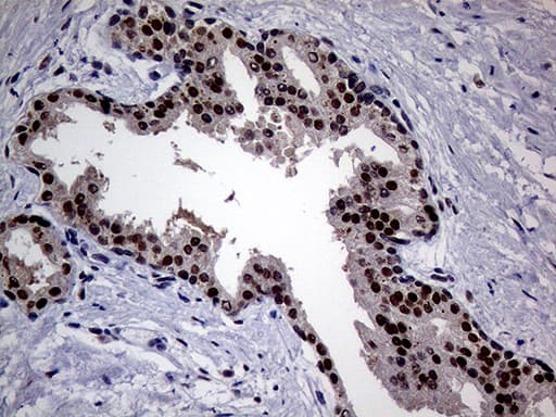 Monoclonal Mouse anti-Human UPRT Antibody (clone OTI1D12, IHC, WB)