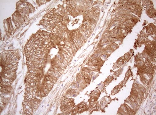 TWF1 / PTK9 Antibody (aa140-384, clone OTI5C12)