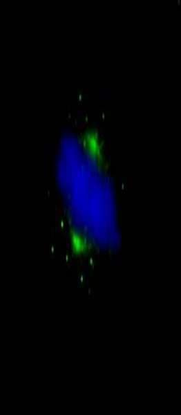 AURKA / Aurora-A Antibody (aa75-125)