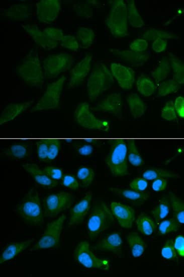 PDE1B Antibody
