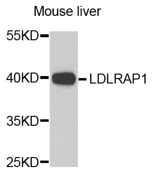 ARH / LDLRAP1 Antibody