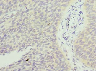 Polyclonal Rabbit anti-Human FXYD5 / Dysadherin Antibody (IHC)