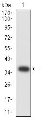 CTNNB1 / Beta Catenin Antibody (clone 7C5A2)