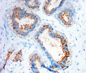 CXCR4 Antibody (aa18-33)