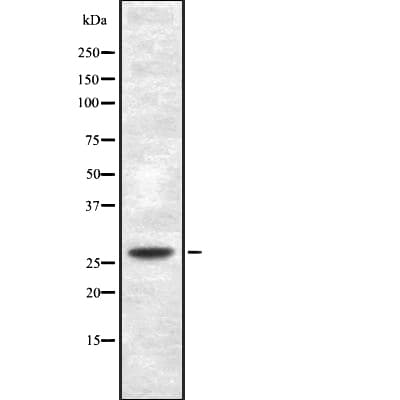 SIP / TP53INP1 Antibody