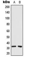 CEACAM21 Antibody (Internal)