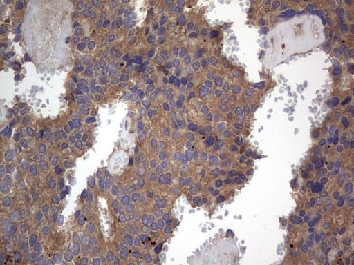 Monoclonal Mouse anti-Human ARAF / ARAF1 / A-RAF Antibody (clone OTI2G9, aa145-365, IHC, WB)