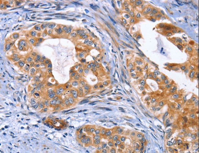 MUSK Antibody