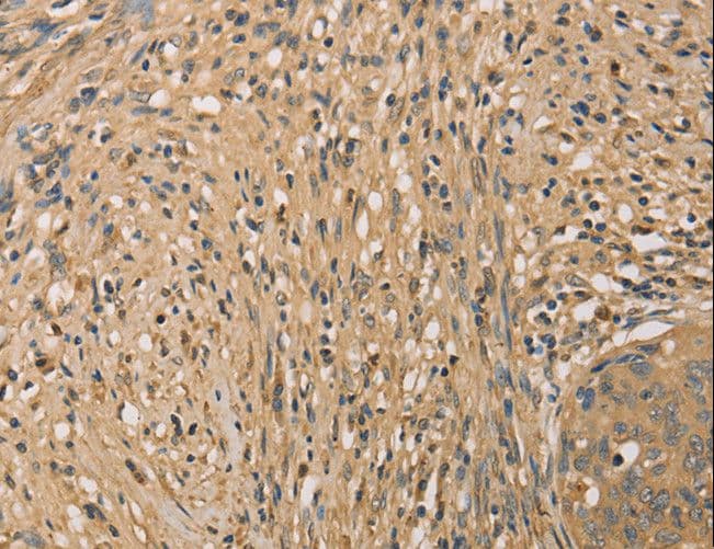 SETD2 Antibody