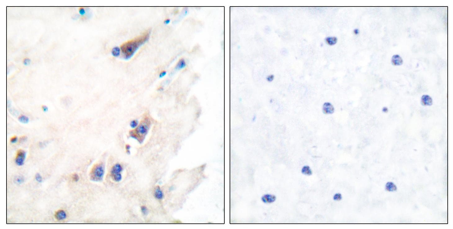 Polyclonal Rabbit anti-Human PLCB3 Antibody (p1105, IHC, WB)