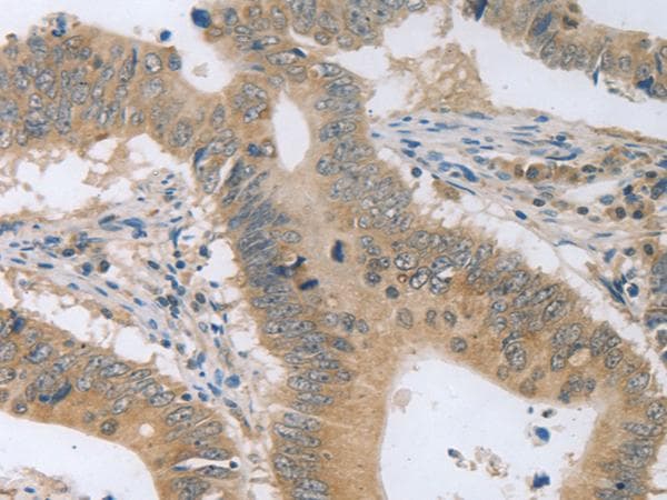 P2RY11 / P2Y11 Antibody