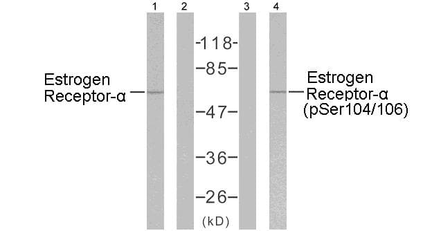 ER Alpha / Estrogen Receptor Antibody (p104/106)
