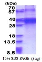 Human FHL3 Protein (Recombinant His)