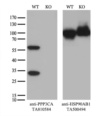 PPP3CA / CCN1 / Calcineurin A Antibody (aa2-105, clone OTI5C6)