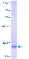 Human PSIP1 / LEDGF Protein (Recombinant GST)