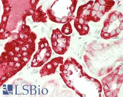 PathPlus™ CDH16 / Cadherin 16 Antibody (clone CDH16/1071)