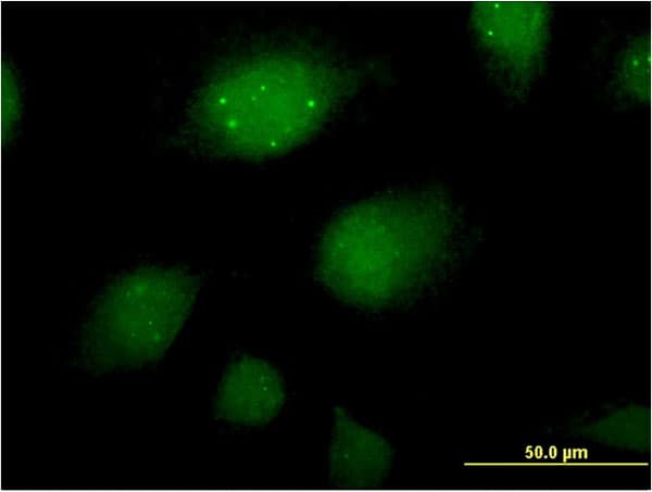 ING2 Antibody (clone 1D1)