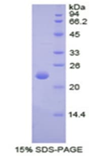 Rat SPTAN1 / Alpha Fodrin Protein (Recombinant His)