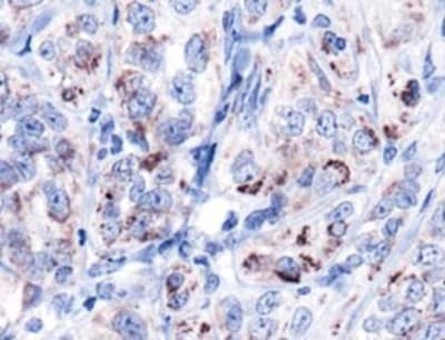 HSPD1 / HSP60 Antibody (Biotin)