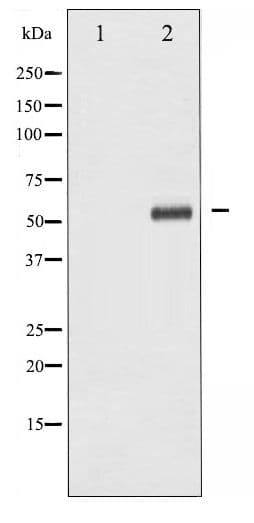 p56lck / LCK Antibody (phospho-Tyr393)