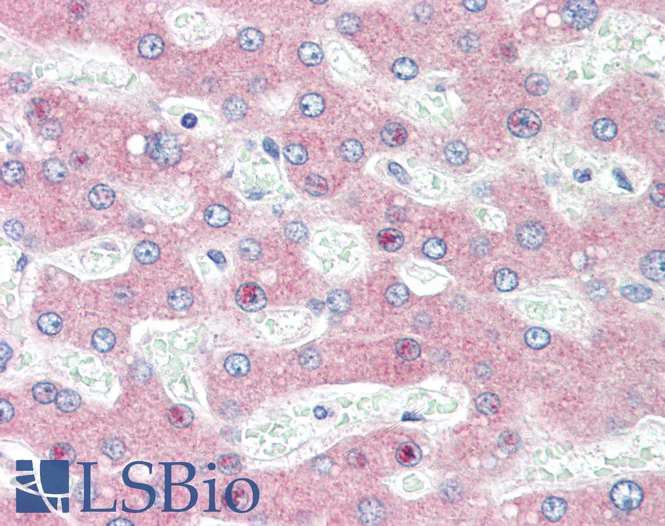 IHC-plus™ Polyclonal Rabbit anti-Rat HYOU1 / ORP150 Antibody (C-Terminus, IHC, WB)