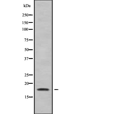Polyclonal Rabbit anti-Human RARRES3 Antibody (WB)