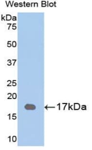 VSX2 / CHX10 Antibody (aa2-135)