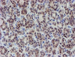 Monoclonal Mouse anti-Human Mannose Phosphate Isomerase Antibody (clone OTI4E7, IHC, WB)