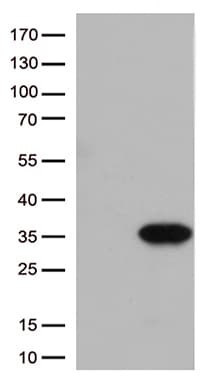 MIBP / ITGB1BP3 Antibody (clone OTI1A12)
