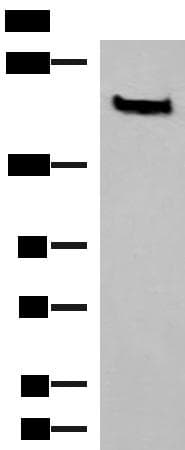 NCAN / Neurocan Antibody