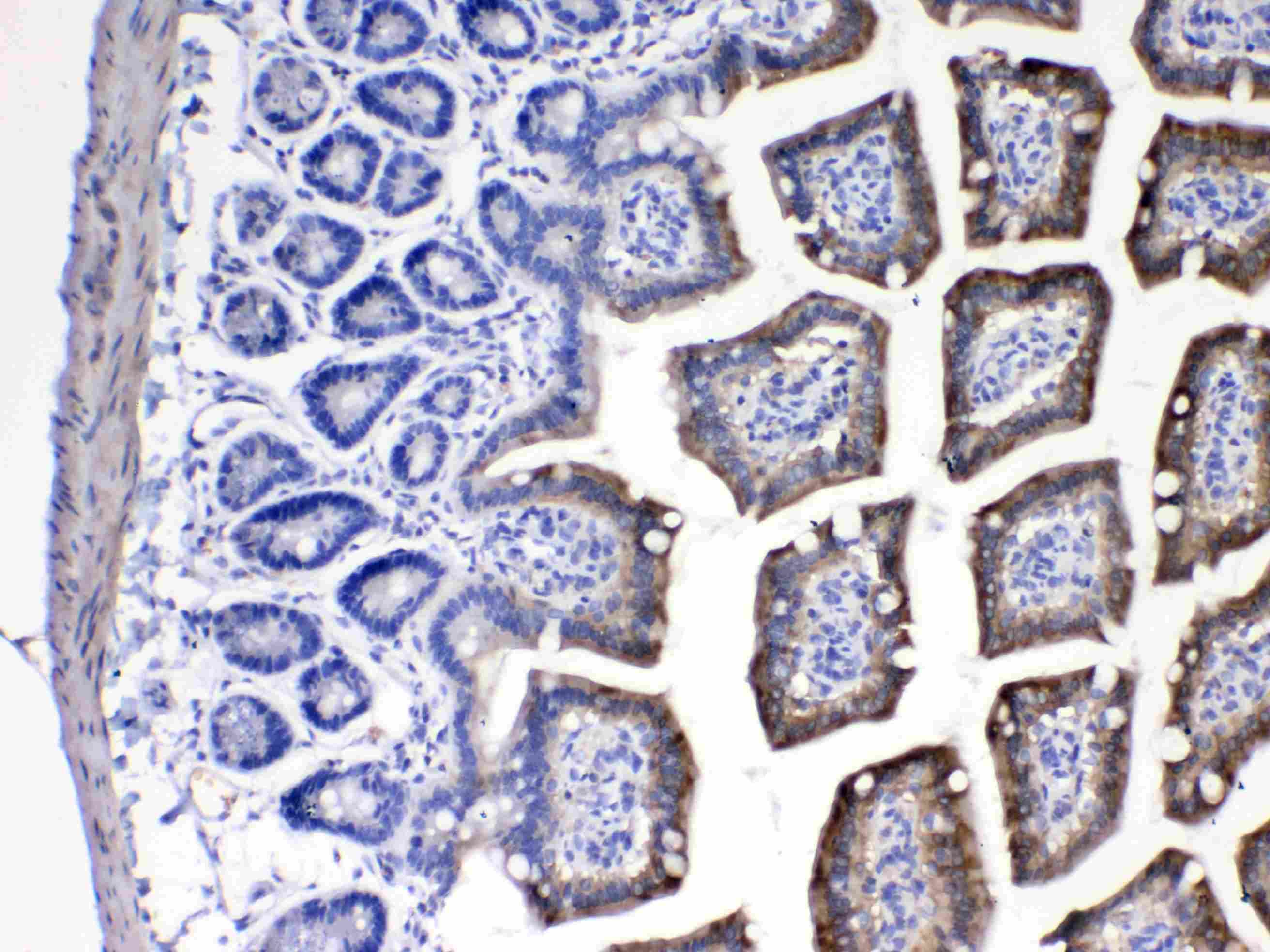 Polyclonal Rabbit anti-Human CYP2D6 Antibody (IHC, WB)