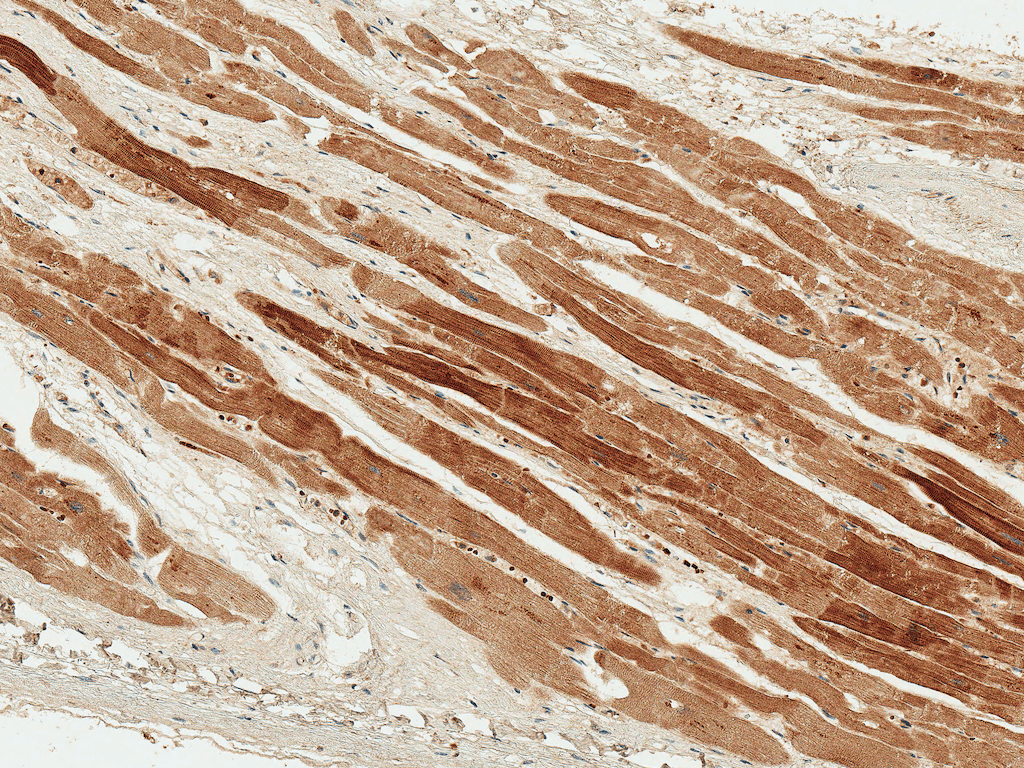 PDGF-BB Antibody (Biotin)
