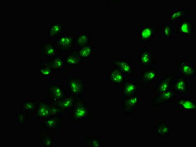 Polyclonal Rabbit anti-Human HIST1H2AI Antibody (IHC)