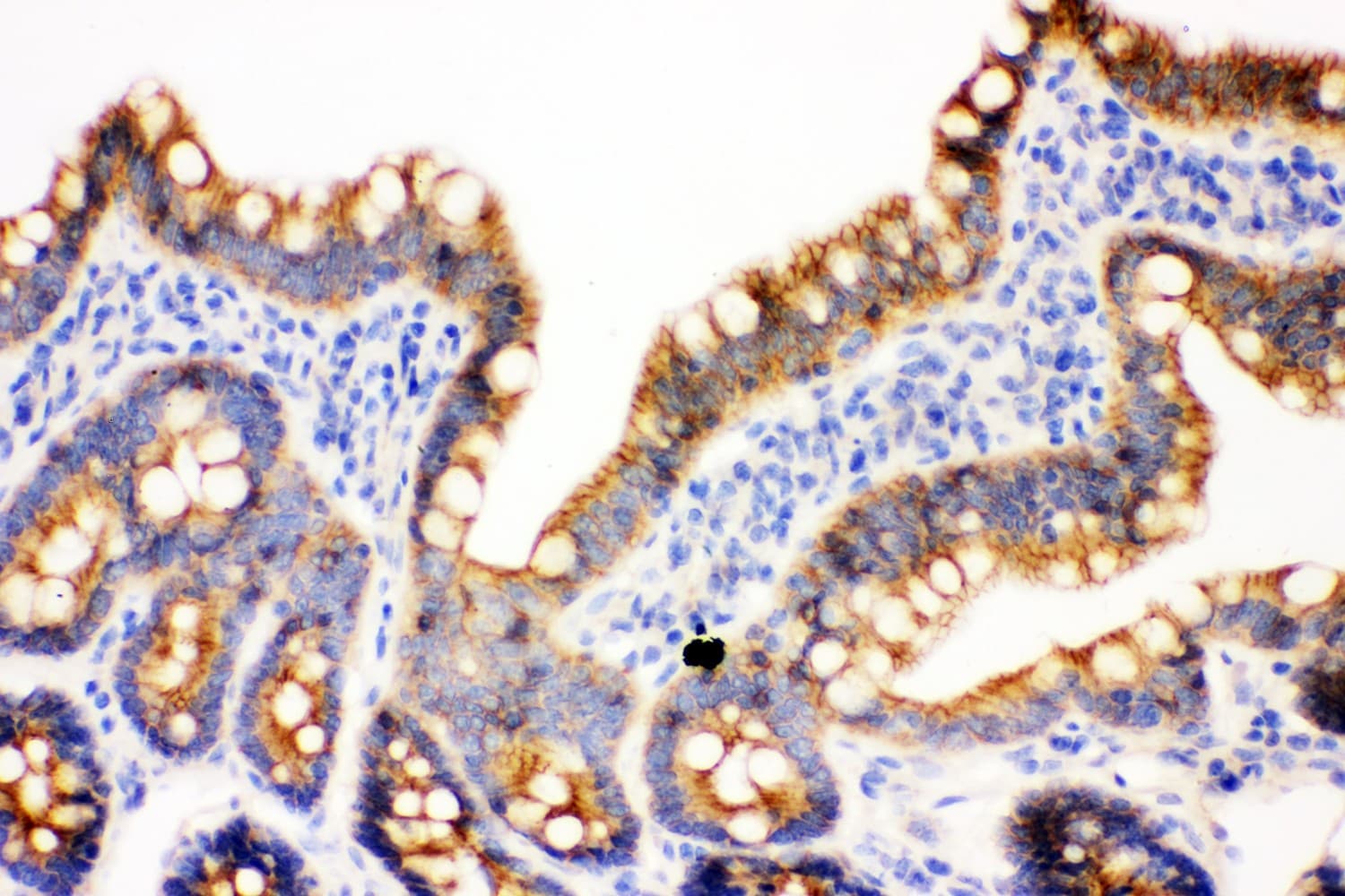 JUP/CTNNG/Junction Plakoglobin Antibody (aa556-745)